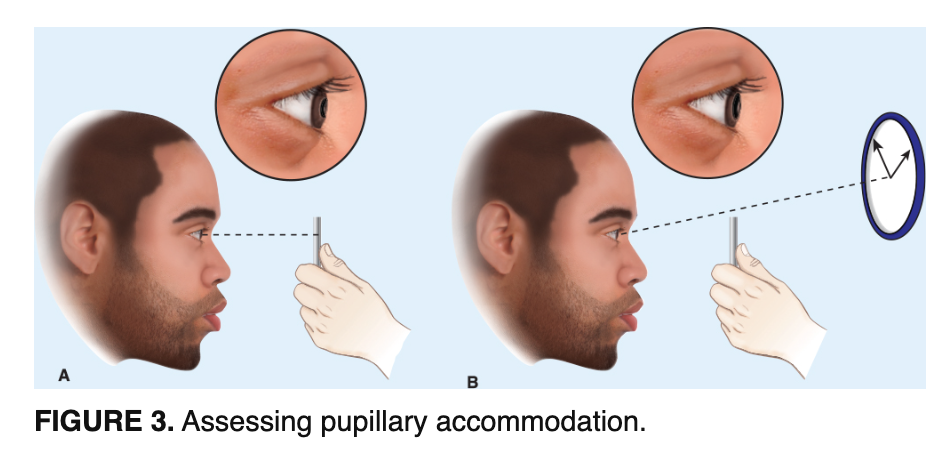 <p>The pupil’s ability to constrict when looking at near object and dilate when looking at distant objects</p>