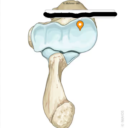 <p>What bone landmark is this within the <strong>Radius </strong></p><ul><li><p>(Lateral Forearm Bone, <strong>Antebrachial / Radial Region)</strong></p></li></ul><p></p>
