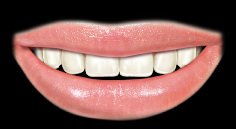 <ul><li><p>see no gums </p></li><li><p>display < 75% of anterior teeth </p></li></ul><p></p>