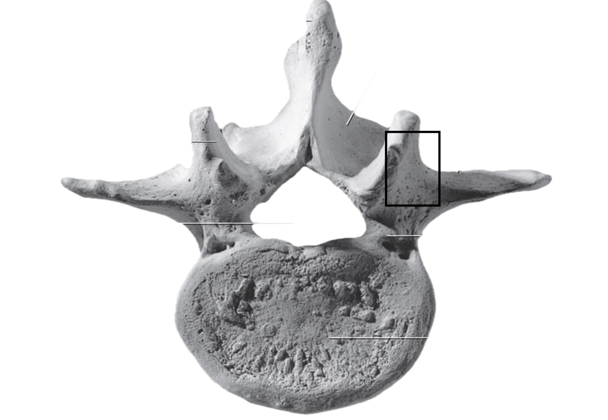 <p>Feature of the lumbar vertebrae </p>
