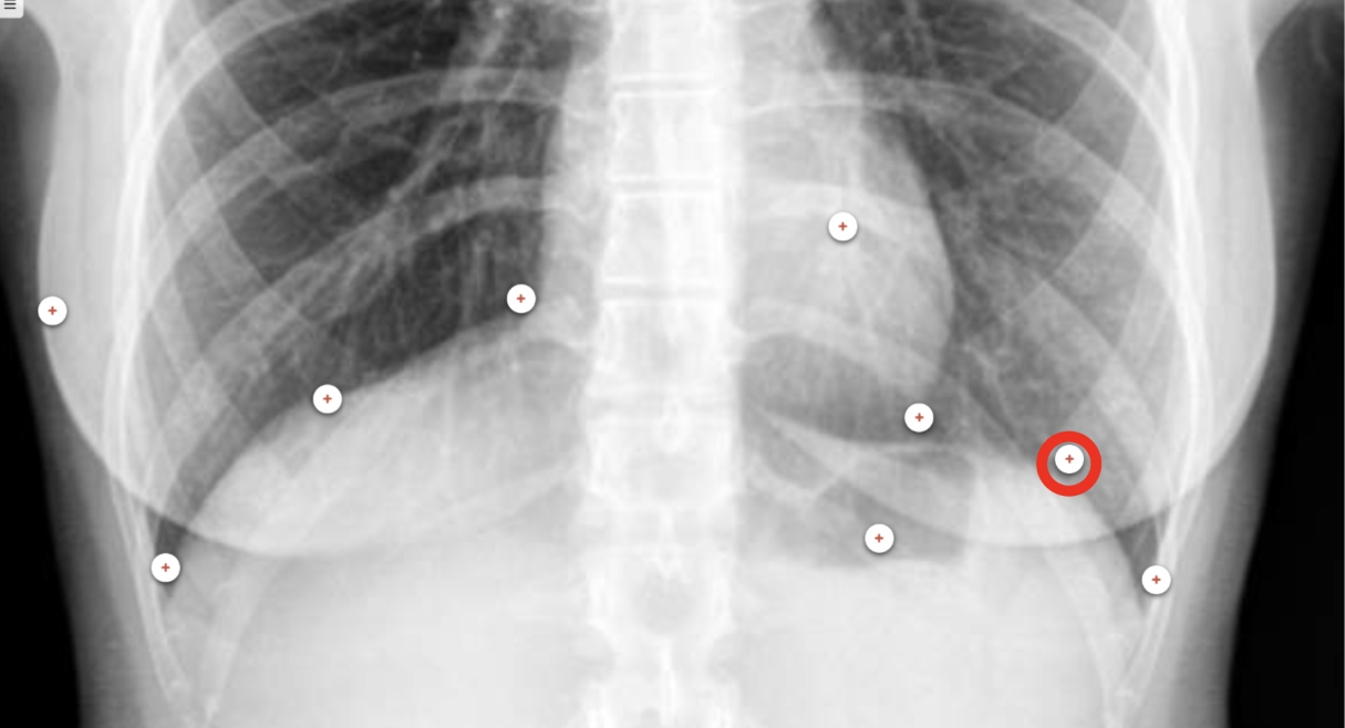 <p>what structure is the red circle labeling?</p>