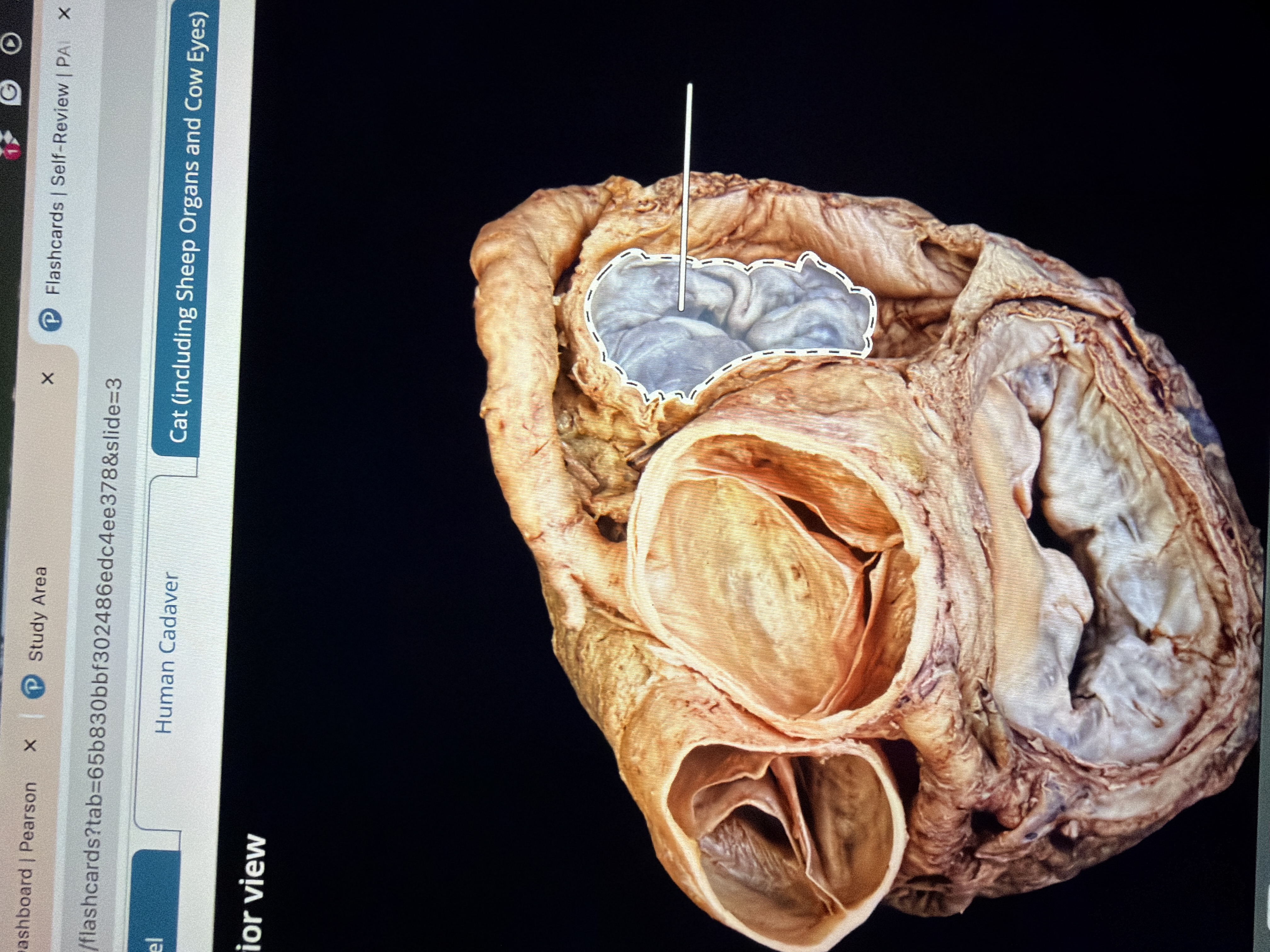 term image