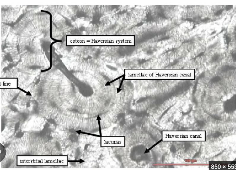 <p>Lamellae which look like the rings on trees </p>