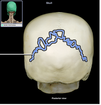 <p>What structure is indicated</p>