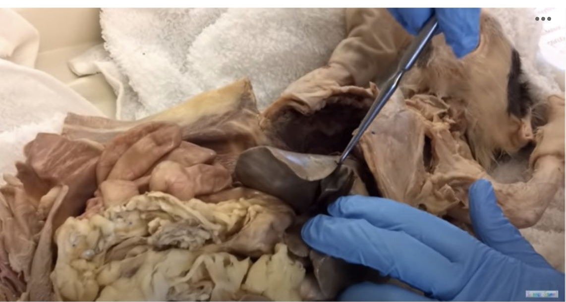 <p>Identify the structure at the tip of the professors dissection probe</p>