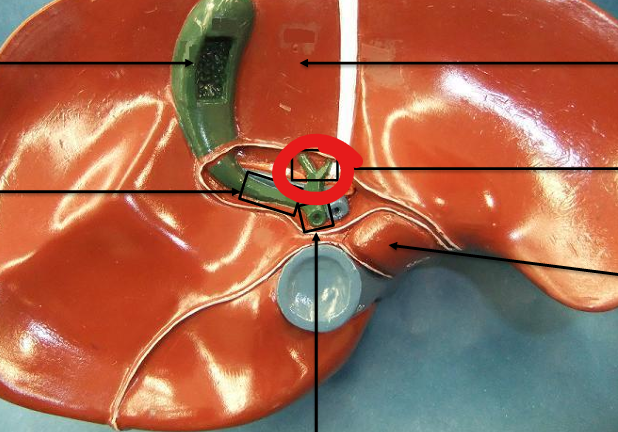 <p>What is this structure </p>
