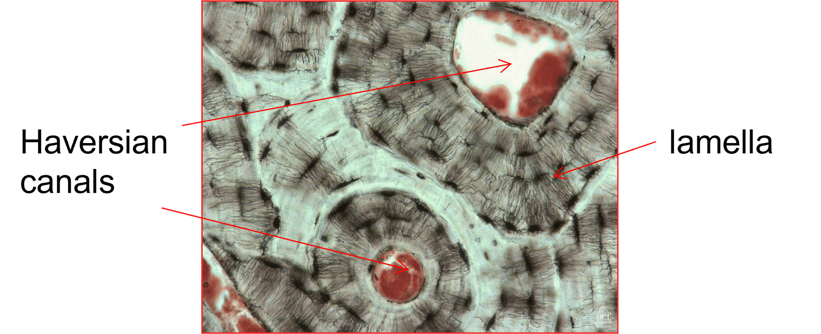 <p>Cortical (compact) bone </p>
