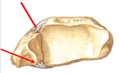 <p><span style="background-color: transparent;">2 of 3 Distal Tibiofibular Joint Ligamentous supports</span></p>