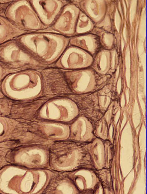 <ul><li><p>provides flexibility </p></li><li><p>forms the cartilage of the external ear and the structure of the epiglottis </p></li></ul><p></p>