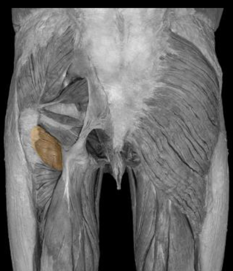 <p>function of quadratus femoris</p>