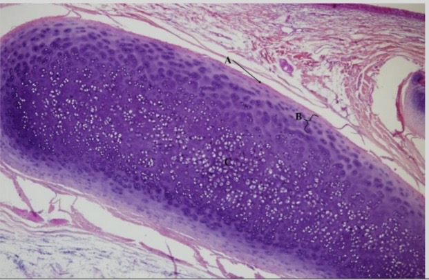 <p>NTK: what type of cartilage is this </p>
