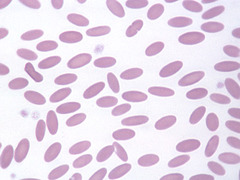 <p>What mammal likely has these as their normal red blood cells?</p>