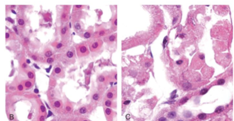 <p>what type of cell death is this and how do u know</p>