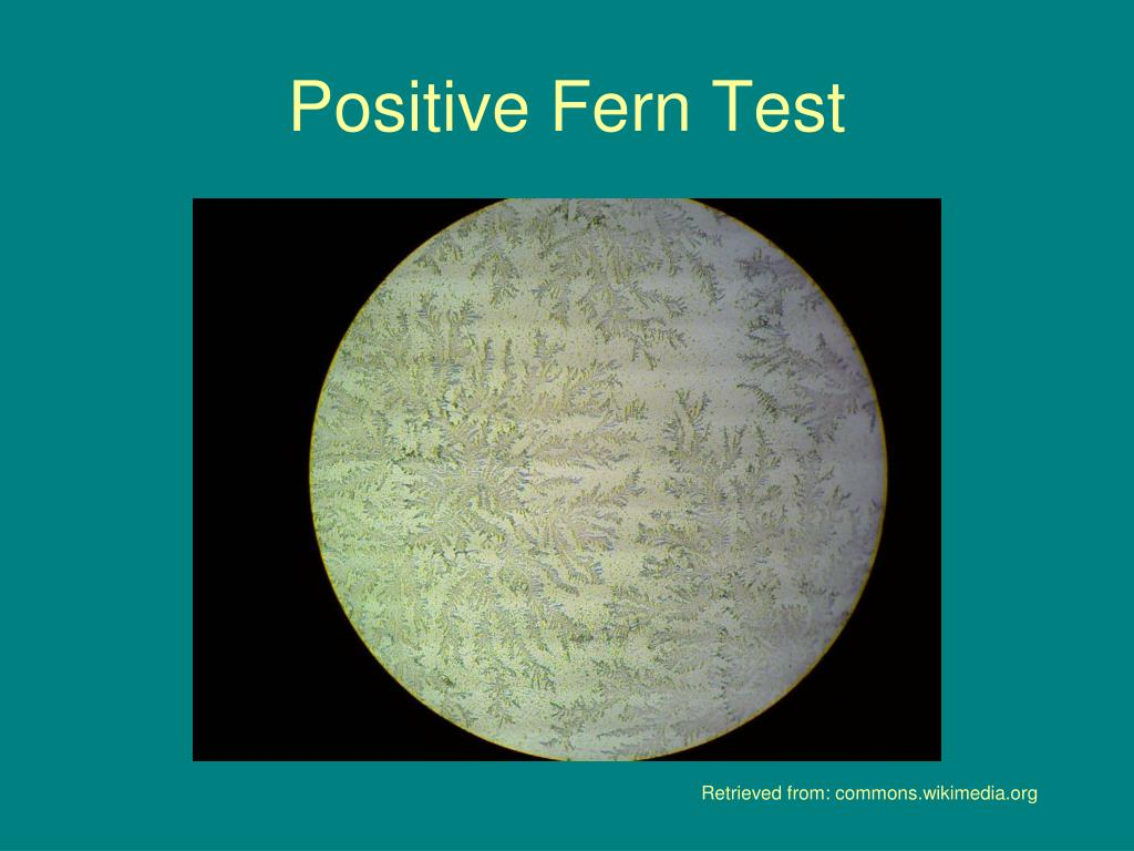 <ol><li><p><span style="color: rgb(38, 118, 180);"><strong>Nitrazine test</strong> (pH test)</span></p></li></ol><ul><li><p><span style="color: rgb(38, 118, 180);">if paper turns <strong>blue= water broke</strong></span></p></li></ul><ol start="2"><li><p><span style="color: rgb(26, 143, 44);"><strong>Fern </strong>Test</span></p></li></ol><ul><li><p><span style="color: rgb(26, 143, 44);">vaginal fluid under <strong>microscope</strong></span></p><ul><li><p><span style="color: rgb(26, 143, 44);"><strong>fern pattern</strong>/frost = water broke</span></p></li></ul></li></ul><ol start="3"><li><p><span style="color: rgb(240, 84, 207);"><strong>AmniSure ROM </strong>Test (Immunoassay testing)</span></p></li></ol><ul><li><p><span style="color: rgb(240, 84, 207);"><strong>vaginal swab</strong> checks for <strong>protein </strong>found in amniotic fluid</span></p></li></ul><p></p>