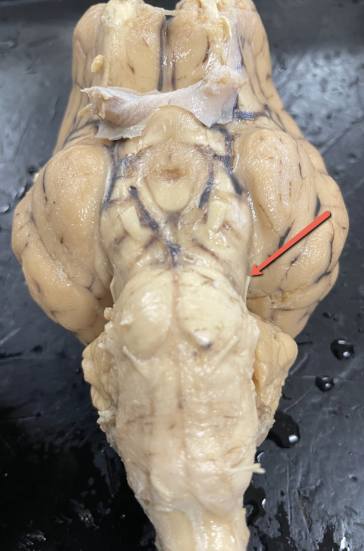 <p><span>Identify the cranial nerve indicated by the pointer.</span></p>