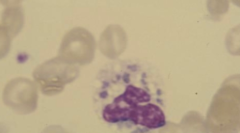 term image