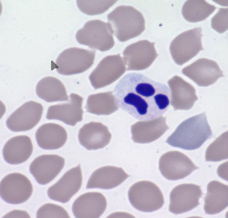 <p>Indicates non toxic enviroment</p><p>Slow progressive cellular death</p>