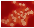 <p>Beta hemolytic</p>