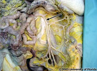 <p>what vein is being pictured (context, parts of the small intestine have been moved)?</p>