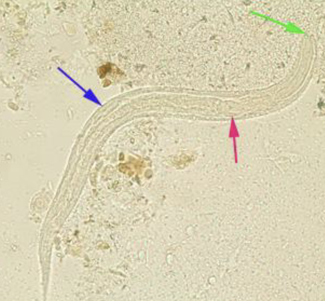 <p>Prominent genital primordium (blue arrow)</p><p>Rhabditoid esophagus (red arrow)</p><p>Short buccal canal (green arrow)</p>