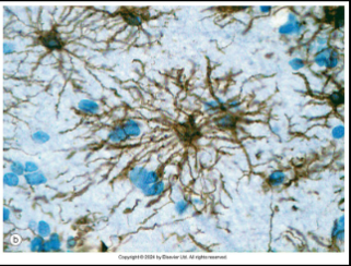 <p>main aid in bld brain barrier; surrounds Somas and processes of neurons</p>