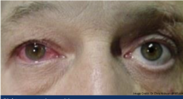 <p>Describe and give diagnosis ?</p>