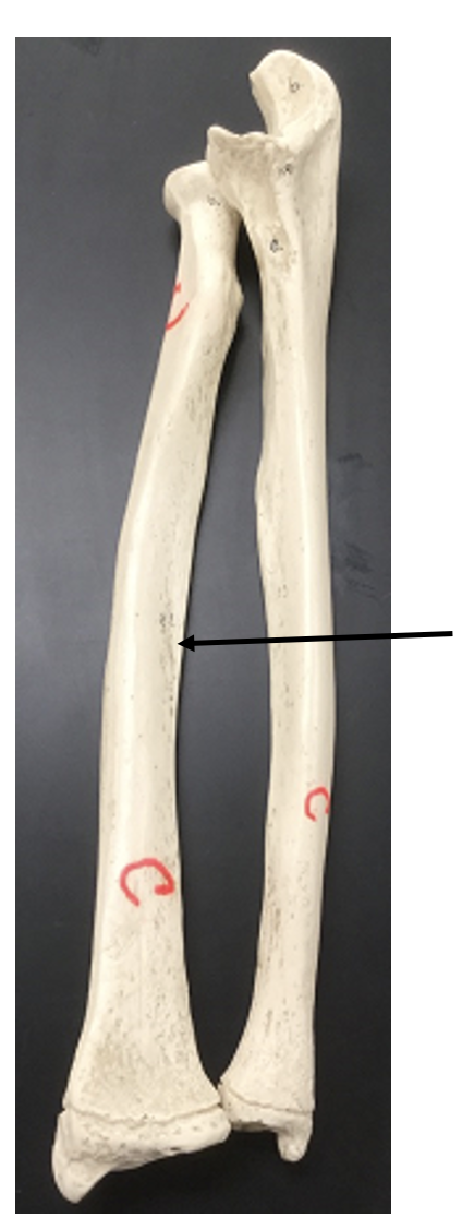 <p>What bone and bone feature is this?</p>