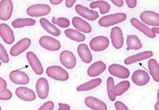<p>name the type of RBC</p>