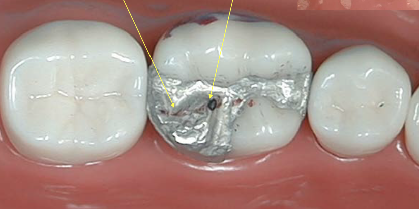 <p>The red marks indicate ____ interference</p>