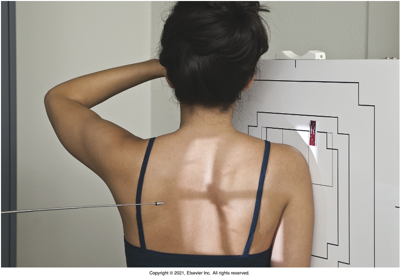 <p>fix elbow to 90° and place hand across the front of the body, epicodyles should be superimposed, abduct the arm so that the humeral shaft is separate from the body, align the acj and the medial border of the scapula to be perpendicular to the detector </p>