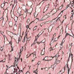 <p>reticulin</p>