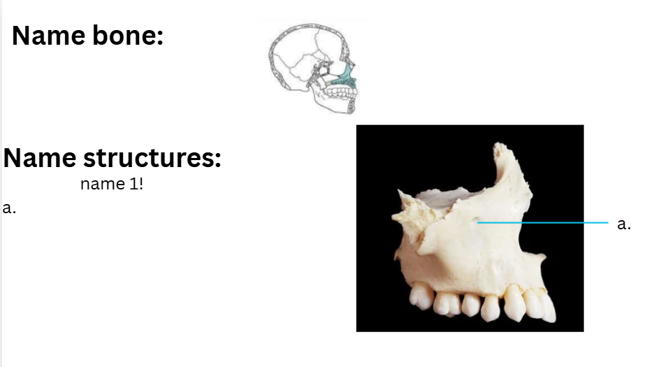 <p>Bone?</p>