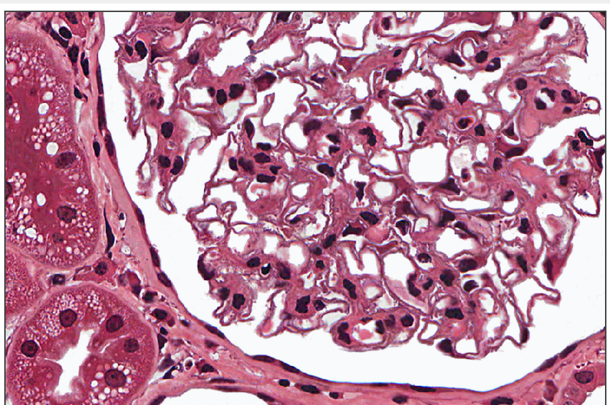 <p>what tissue type is this</p>