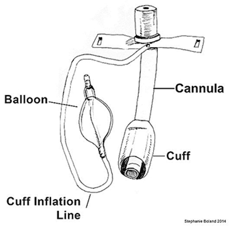 <p>what type of tracheostomy tube?</p>