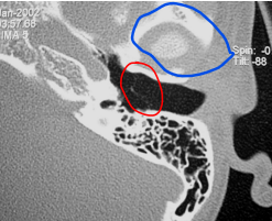 term image