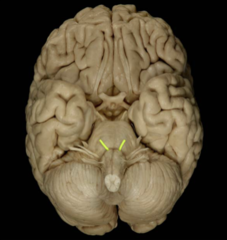 <p>what cranial nerve is the highlighted section</p>