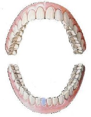 <p>mandibular right central incisor</p>