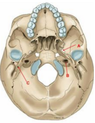 <p>D. CN V3, mandibular nerve</p>