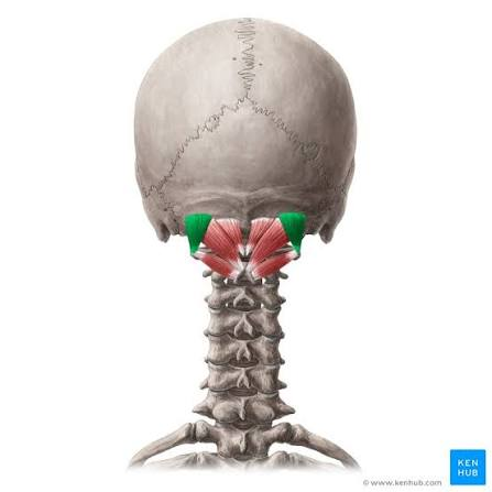 <p>O: TP of C1</p><p>I: occiput between superior and inferior nuchal lines</p><p>A: extend head, ipsilateral lateral flexion</p><p>N: posterior ramus of C1 (suboccipital nerve)</p>