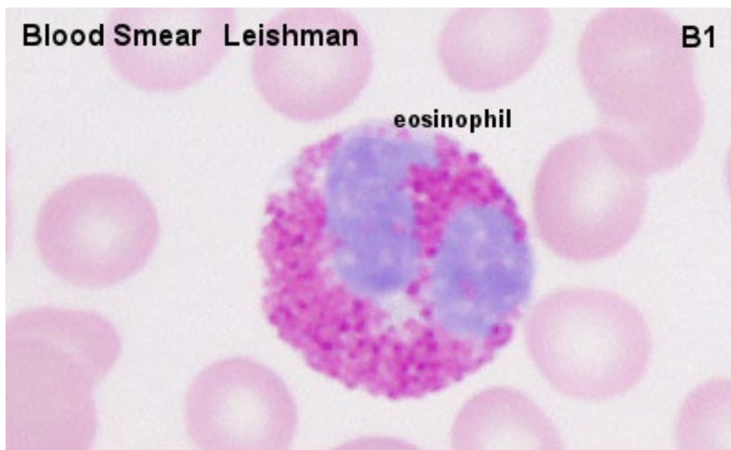 <ul><li><p><strong>Nucleus </strong>typically divided into <strong>2 lobes</strong></p></li><li><p>Almost all of the <strong><em>cytoplasm appears filled with granules</em></strong></p></li><li><p>Granules are not neutral but stain<span style="color: rgb(243, 41, 173);"> red or pink</span></p></li><li><p>Main function → defense against <span style="color: rgb(245, 38, 38);"><strong>parasitic infections</strong></span></p></li></ul><p></p>