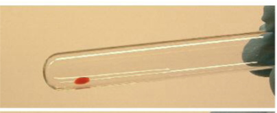 <p>one large aggregate</p>