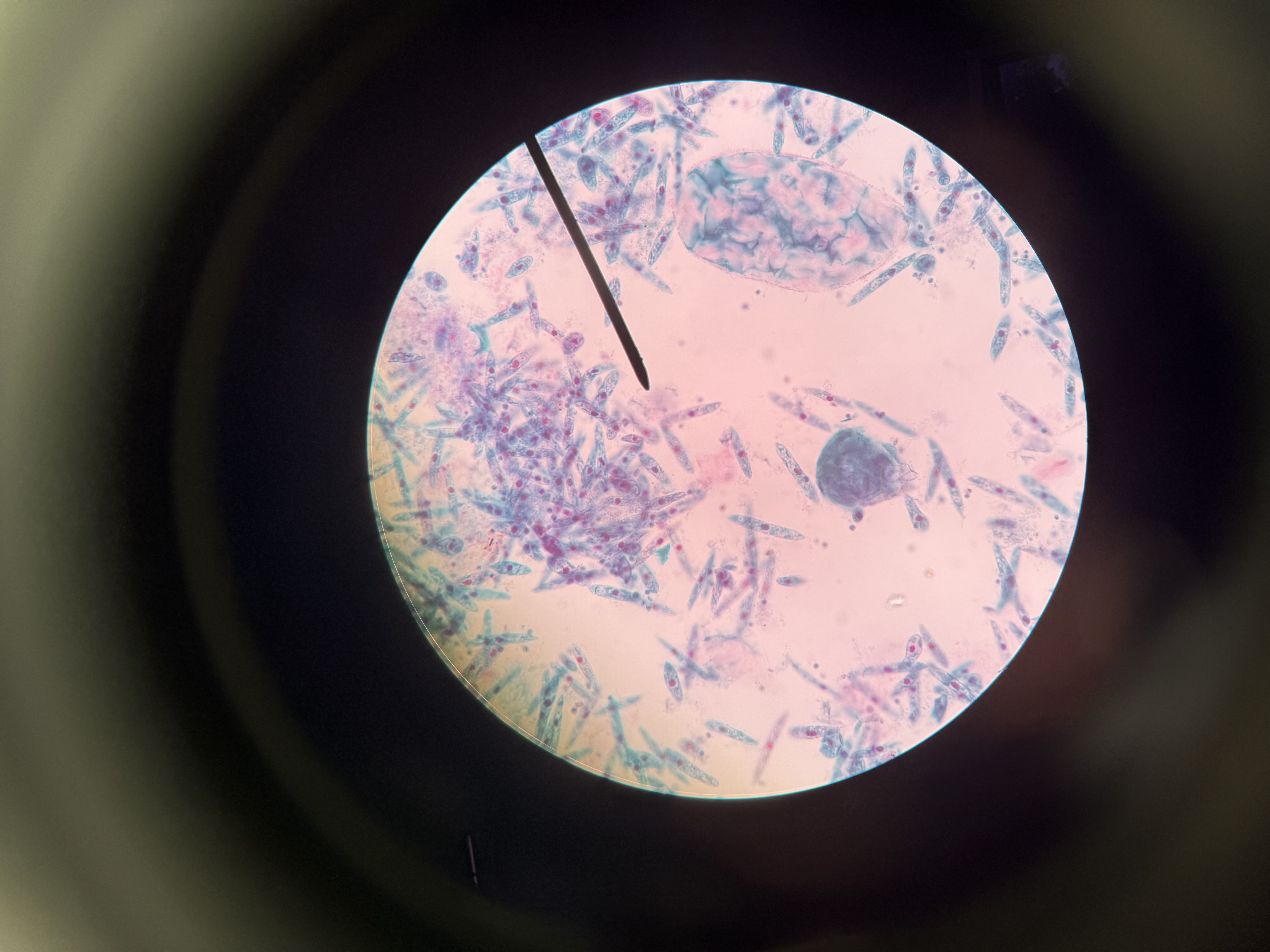 <ol><li><p>What is this?</p></li><li><p>What phylum?</p></li><li><p>Spore location?</p></li><li><p>Autotrophic or heterotrophic?</p></li><li><p>Unicellular or multicellular?</p></li><li><p>What did it evolve through?</p></li><li><p>Can you identify the flagella?</p></li></ol><p></p>