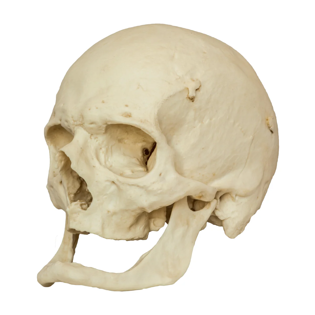 <p>{TYPE OF SKULL}</p>