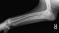 <p>A young dog has shifting leg lameness and radiographic changes consistent with increased medullary opacity in long bones. What is the most likely diagnosis?</p><p>A. HOD</p><p>B. Panosteitis</p><p>C. Osteomyelitis</p><p>D. Osteochondrosis</p>