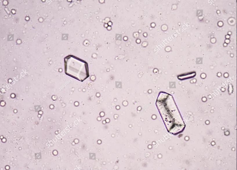 <p>The crystals show are rectangular prisms that resemble coffin lids, what are they called? The pH is 8.5</p>