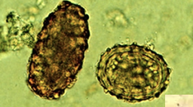 <p>infective stage is the embryonated egg containing L3 larva. transmitted though ingestion of embryonated eggs from contaminated soil, food, water, or hands. found worldwide and infects 25% of the population. sympt:lung phase is loefflers syndrome and intestinal phase is usually asymptomatic but heavy infection can lead to volvulus. hint: can resist very acidic environments, round and soft is fertilized egg</p>