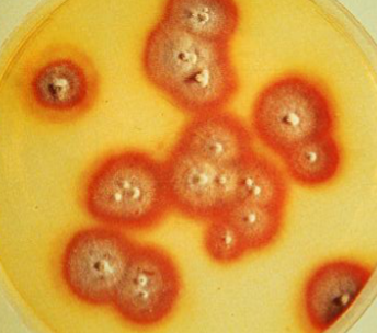 <p>Trichophyton rubrum</p>