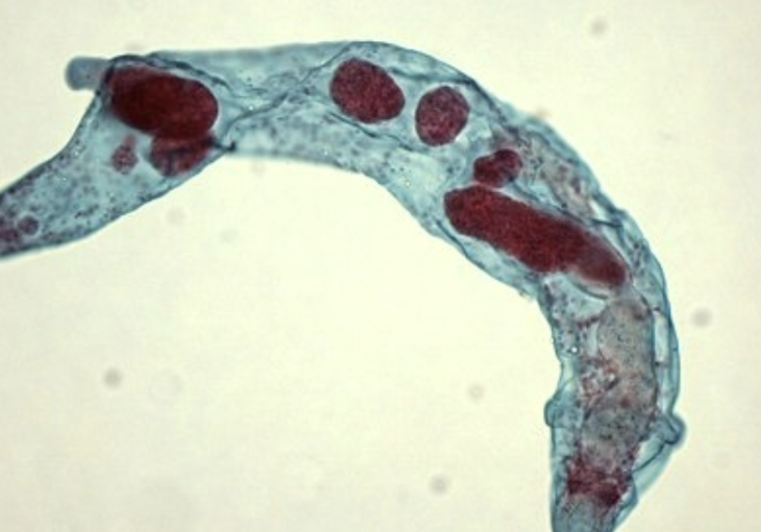 <p>What stage is this fluke relating to the fluke life cycle?</p>