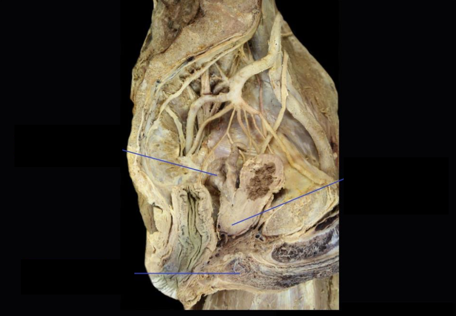 <p>Identify</p><p>Side Question:</p><p>Lobe of this structure with no glandular tissue?</p><p>Upper surface of the medial lobe of this is related to which structure?</p><p>Its apex lies against which structure below and is closely related to?</p><p>Its base lies against which structure and is closely related to?</p>