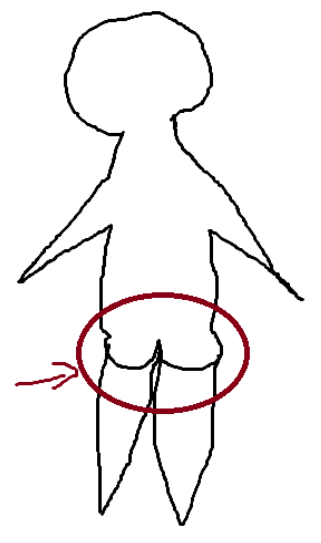 <p>Buttocks region</p>